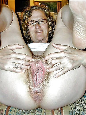 free amature matured vulva pictures
